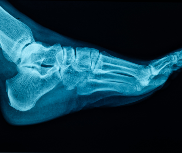Unexplained Foot Pain? Advanced Diagnostics = Answers!
